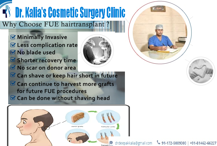 Dr. Kalia Hair Transplant Clinic